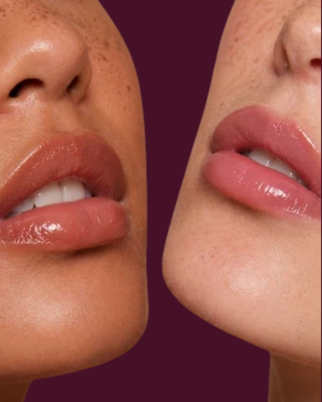 Lips