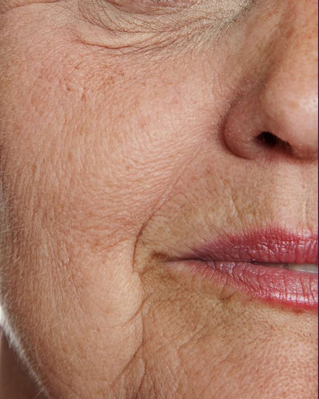 Anti-Aging