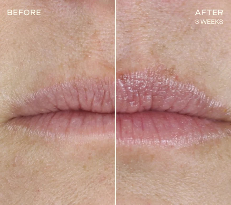Replenishing Lip Filler Duo