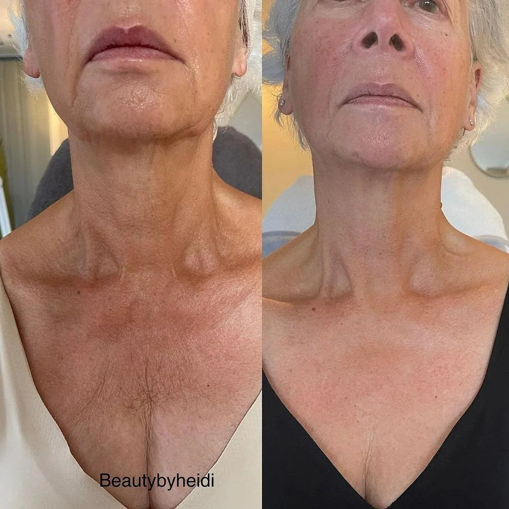 KRX Neck Lift Intensive Firming Cream