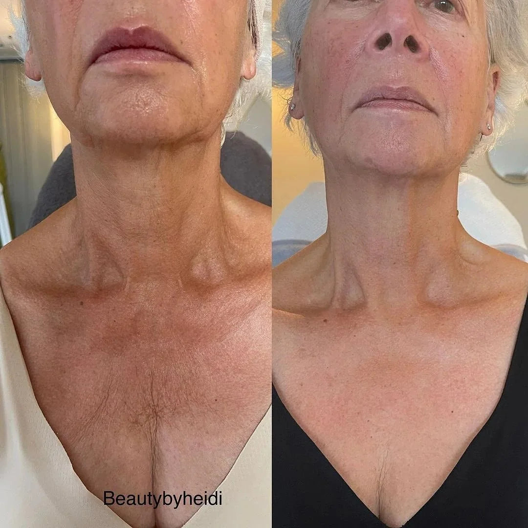 KRX Neck Lift Intensive Firming Cream