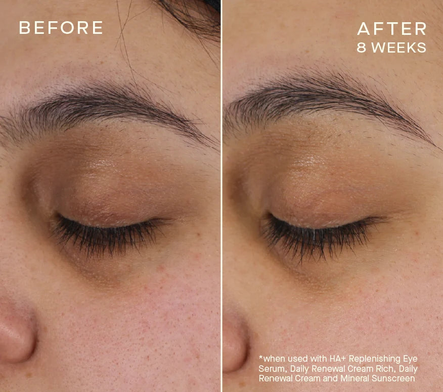 Advanced Regenerative Eye Serum