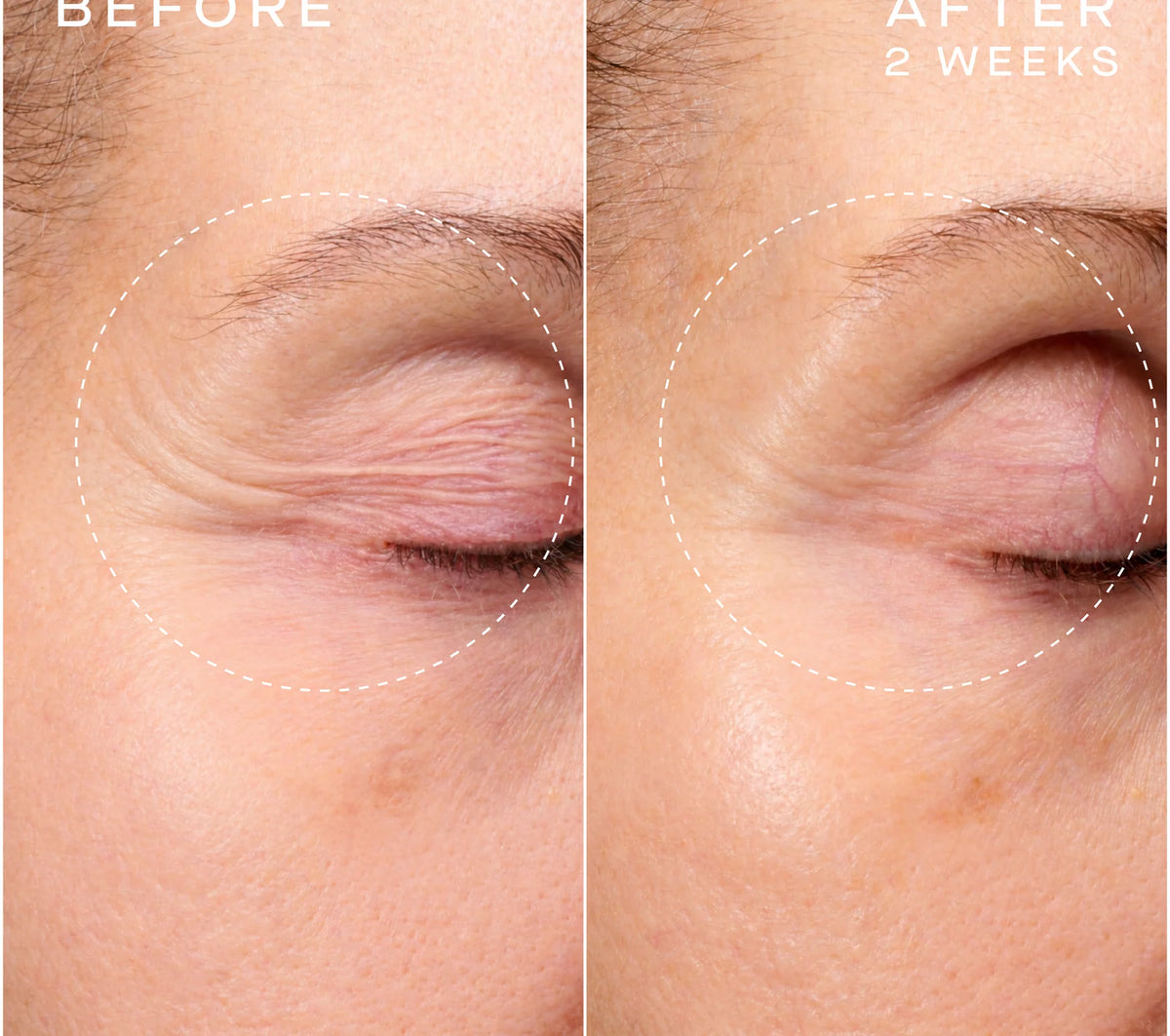 Advanced Regenerative Serum