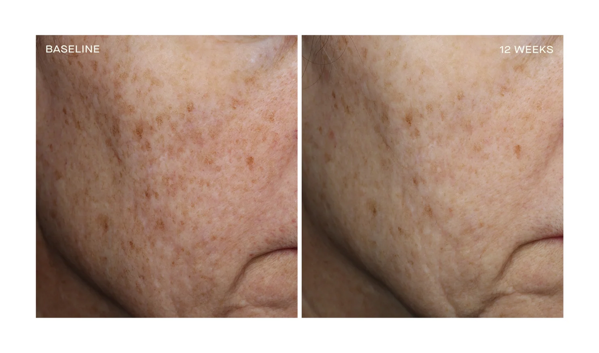 Complexion Brightening Serum
