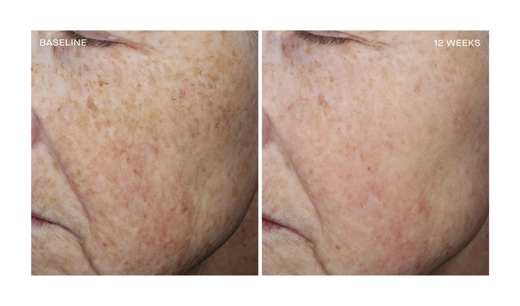 Complexion Brightening Serum