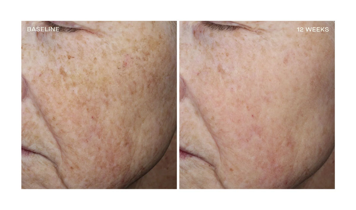 Complexion Brightening Serum