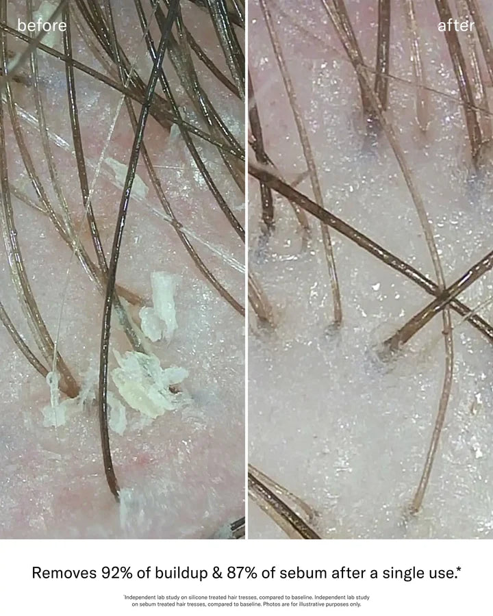 SEEN Scalp Clarifying Shampoo, Fragrance Free