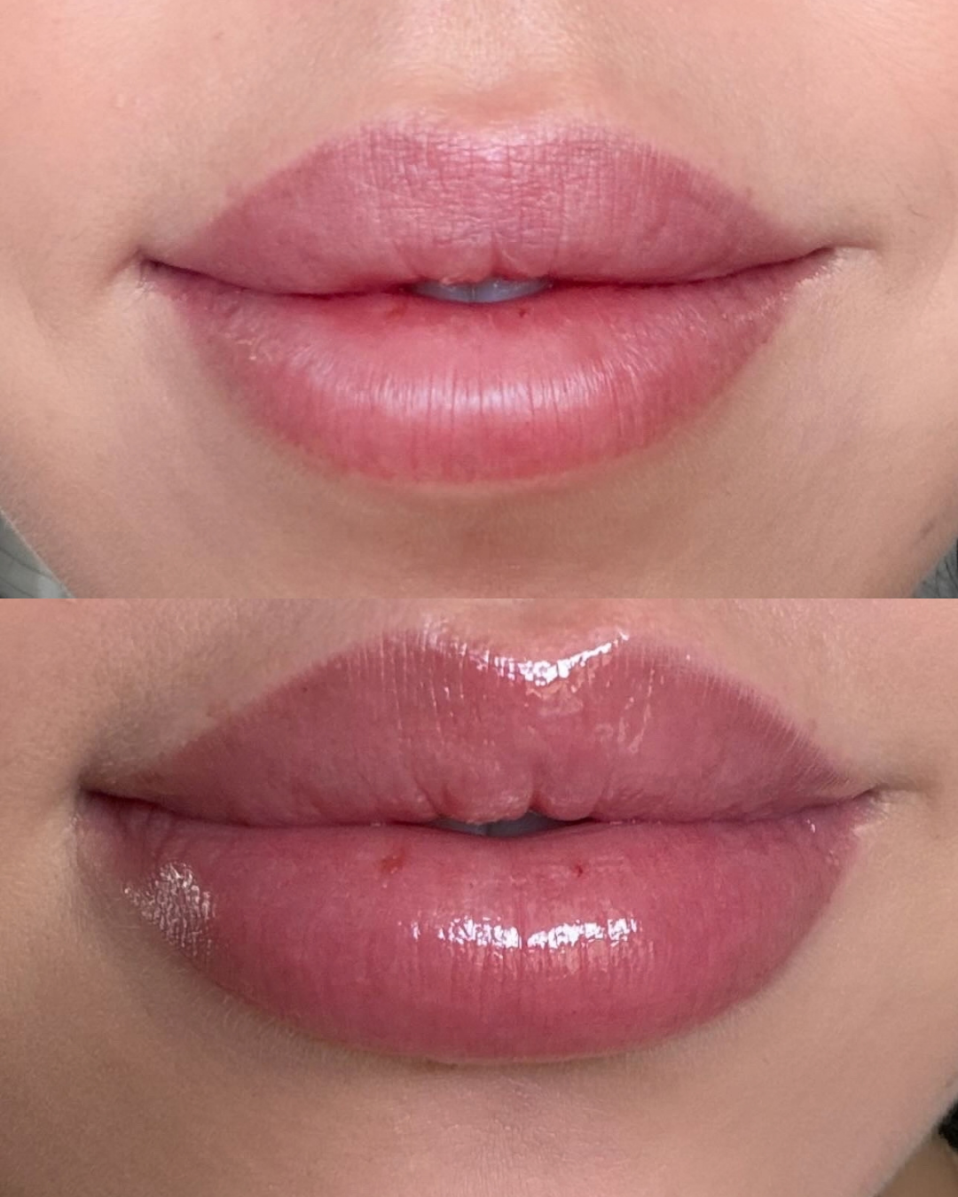 Replenishing Lip Filler
